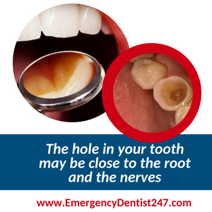 247 emergency dentist chicago