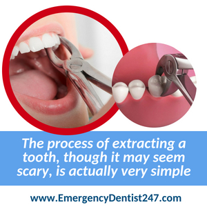 247 emergency dentists houston