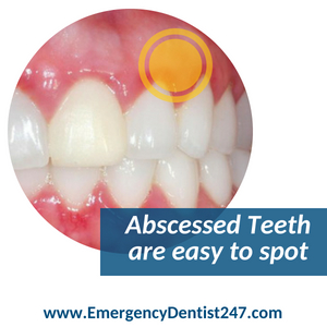 emergency dentist houston 247