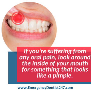 abscessed teeth and oral infections dental emergency 247 spokane valley