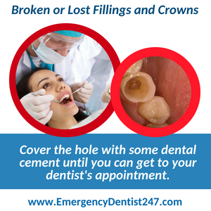 broken fillings and crowns - emergency dentist 247 san jose