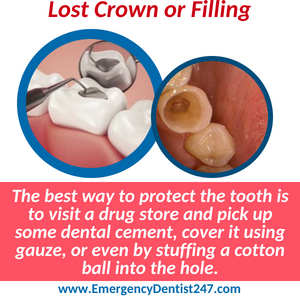 emergency dentist 247 bronx nyc loss of a crown or filling