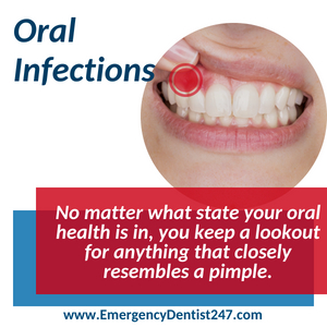 emergency dentist 247 bronx nyc oral infections