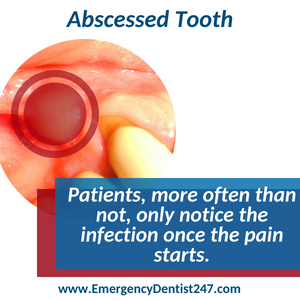 emergency dentist 247 chelmsford ma abscessed teeth and oral infections