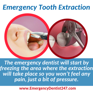 emergency dentist 247 chelmsford ma emergency tooth extraction