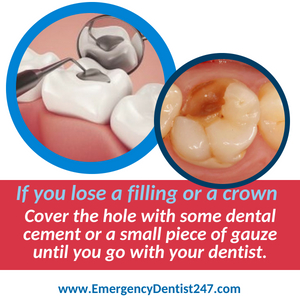 emergency dentist 247 chelmsford ma losing a filling or a crown