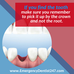 emergency dentist 247 indianapolis losing a tooth