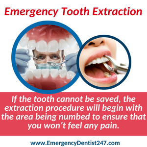 emergency dentist 247 indianapolis tooth extraction