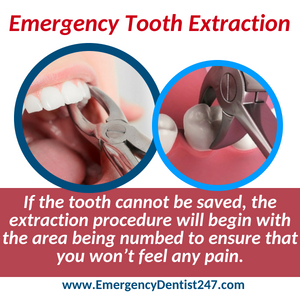 emergency dentist 247 leominster emergency tooth extraction