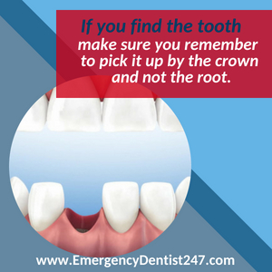 emergency dentist 247 leominster knocked out tooth