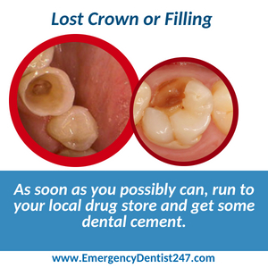 emergency dentist 247 phoenix az - lost crown or filling