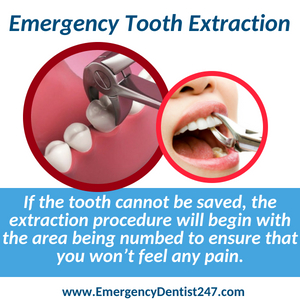 emergency dentist 247 san antonio tx - emergency tooth extraction