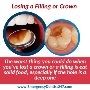 emergency dentist 247 san antonio tx - lost crown or filling