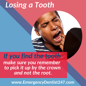 emergency dentist 247 san francisco - losing a tooth