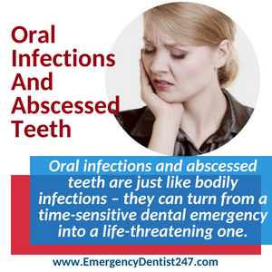 emergency dentist 247 san francisco - oral infections and abscessed teeth