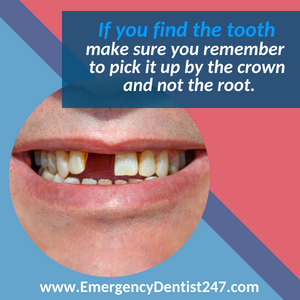 emergency dentist san diego 247 knocked out tooth