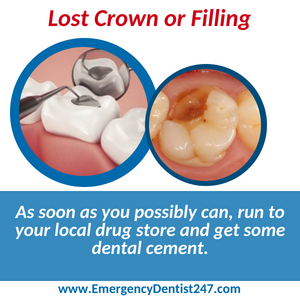 emergency dentist san diego 247 lost crown or filling