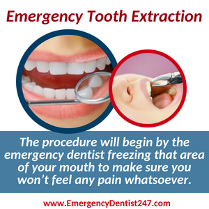 emergency tooth extraction bronx nyc