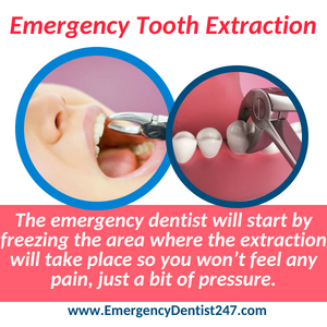 emergency tooth extraction lincroft nj emergency dentist 247