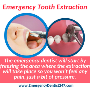 emergency tooth extraction lincroft nj emergency dentist 247