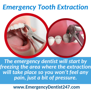 emergency tooth extraction spokane valley