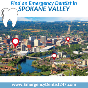 find an emergency dentist in spokane valley
