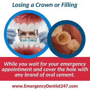 losing a crown or filling - emergency dental 247 queens nyc