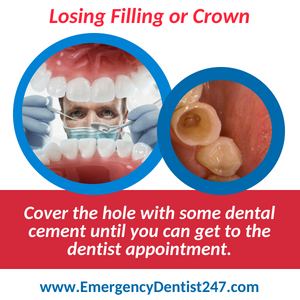 losing a filling or a crown emergency dentist 247 austin