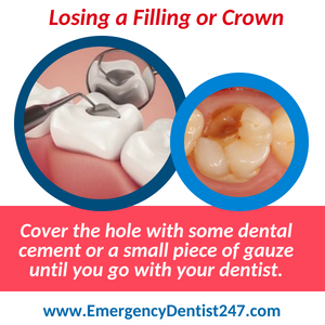 losing filling emergency dentist 247 spokane valley