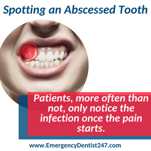 spotting an abscessed tooth lincroft nj emergency dentist 247