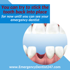 the loss of a tooth emergency dentist 247 austin