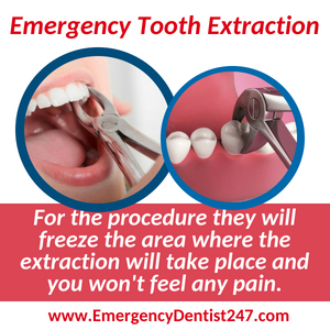 tooth extraction - dental emergency 247 san jose ca