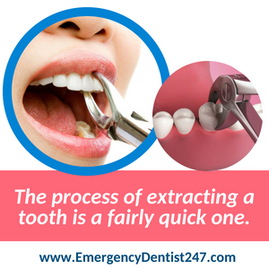 tooth extraction - emergency dentist 247 queens nyc
