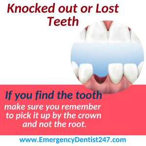 Lost or Knocked Out Teeth