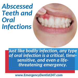 abscessed teeth oral infection hempstead ny