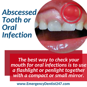 abscessed tooth and oral infection detroit