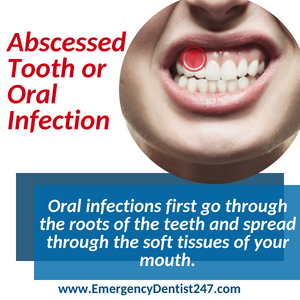 abscessed tooth and oral infections boston ma