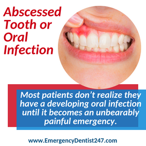 abscessed tooth and oral infections denver co