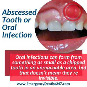 abscessed tooth and oral infections fort worth