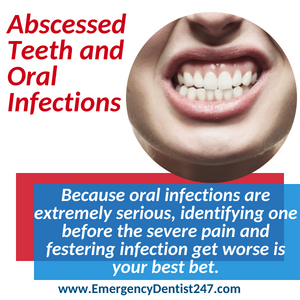 abscessed tooth and oral infections louisville