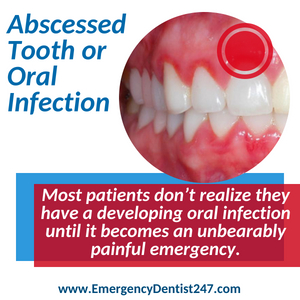 abscessed tooth and oral infections nashville