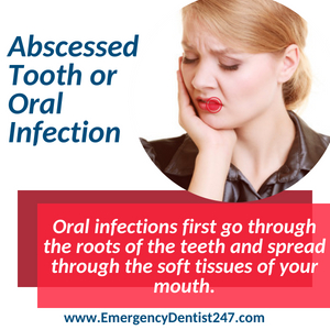 abscessed tooth and oral infections washington dc