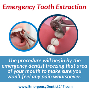 emergency tooth extraction charlotte nc