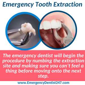 emergency tooth extraction columbus