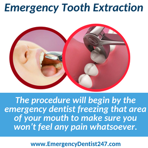 emergency tooth extraction denver