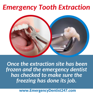 emergency tooth extraction detroit