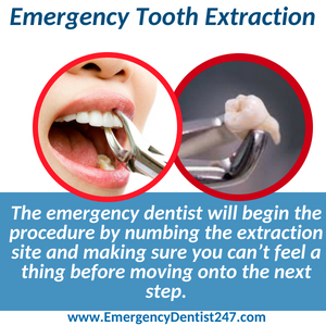 emergency tooth extraction el paso tx