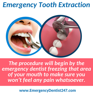emergency tooth extraction hempstead ny