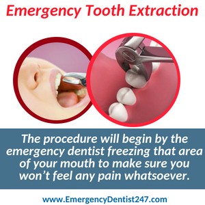 emergency tooth extraction louisville