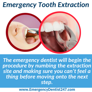 emergency tooth extraction nashville